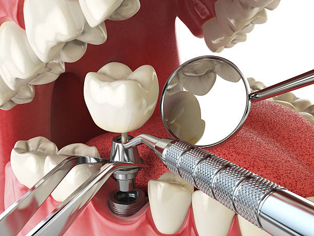 Best Emergency Treatment for Dental Infections or Abscesses in Sperry, OK